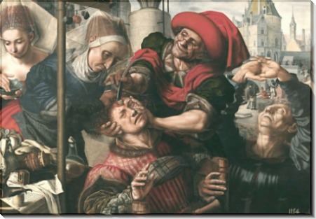 Хирург, 1555 - Хемессен, Ян Сандерс ван